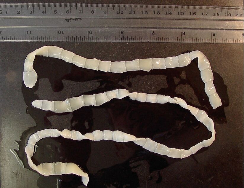 wide tapeworm in the human body